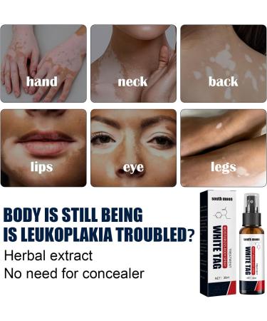 Giltpeak Kolmax Psoriasis & Vitiligo Relief Spray (3 Pcs) | Reduces Symptoms, Suitable for All Skin Types - Buy Online on GoSupps.com