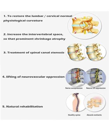 Lumbar Stretching Device For Lumbago Low Back Pain Lumbar Traction Device Efficent Relief Lumbago Low Back Pain Portable Back Lumbar Traction Device For Bed - Buy Online on GoSupps.com