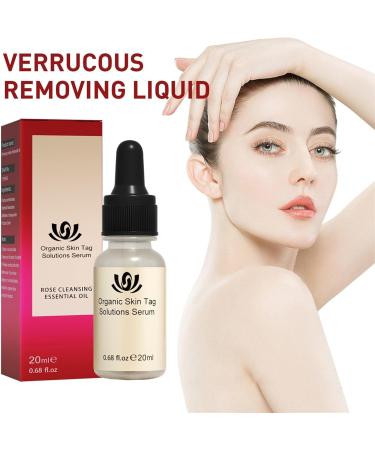 Aibyks 2 Skin Tag Corrector | Natural Mole Remover Cream Natural Skin Tag Removal Mole Corrector for Face Wart and Body Wart - Buy Online on GoSupps.com