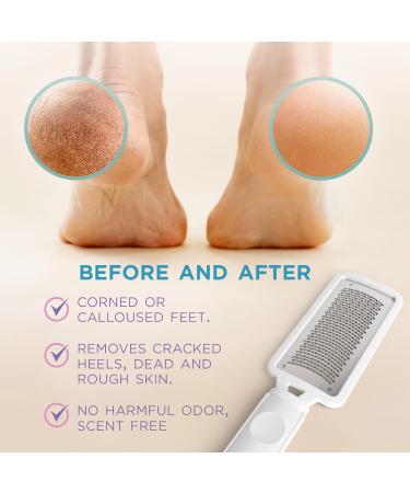 Lee Beauty Callus Remover - Professional Foot File Scrubber for Cracked Heels & Dead Skin - Easy to Use Pedicure Tool for Smooth Feet - International Shipping - Buy Online on GoSupps.com