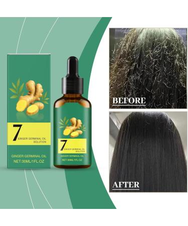 Lngwer Hair oil antihair loss hair serum for women and men conditioner for soft and shiny hair refreshing nonsticky for all hair types and daily care 30 ml 2 pieces 2 pieces - Buy Online on GoSupps.com