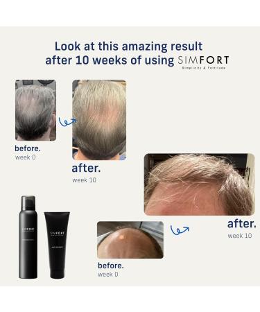 SIMFORT Hair Conditioner for Men & Women - 2 Pack (4.2oz) | Perfect with Carbonic Acid Shampoo - International Shipping Available - Buy Online on GoSupps.com