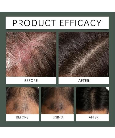 Solution paississante pour cheveux formule douce 30 ml huile de soin du cuir chevelu non grasse huile de croissance des cheveux clairsem s id ale pour les femmes et les hommes apparence plus - Buy Online on GoSupps.com