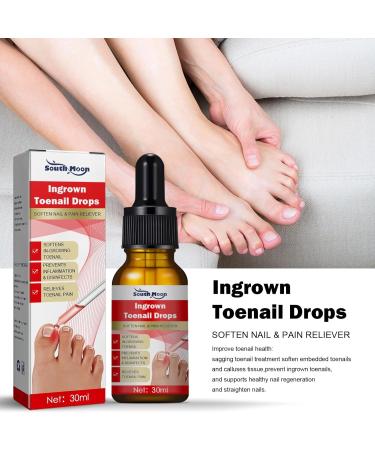 Ingrown Toenail & Fungal Nail Treatment Drops 10ML - Nail Care to Strengthen & Renew Damaged Nails - Buy Online on GoSupps.com