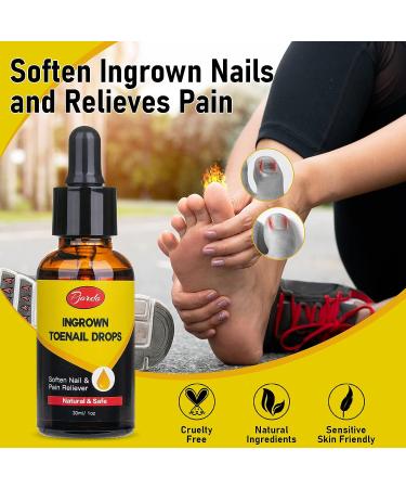 Pjordo Ingrown Toenail Treatment Kit - Includes Drops, Pain Reliever, Softener, Toe Tubes, Clipper, and File Lifter - 30ml/1oz - Buy Online on GoSupps.com