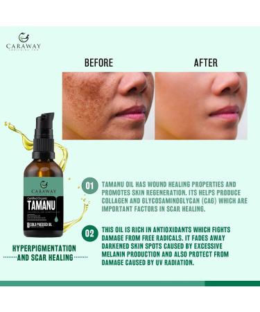 CARAWAY Organic Tamanu Oil - Cold Pressed Natural Moisturizer for Skin Hair & Face - Treats Hyperpigmentation Acne Scars Eczema & Psoriasis - 1.7 Fl oz (50 ml - Buy Online on GoSupps.com