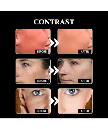 Sunscreen Spf 30 Face | Sunscreen Face | Sun Cream Sun Block Protects Against UVA/UVB Rays | Non-Greasy Water Resistant Sun Lotion| 60g - Buy Online on GoSupps.com