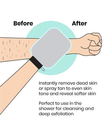 Lindo Dermaglove Deep Exfoliation Mitt - Reveal Softer Skin, Remove Dead Skin, Bumps & Clogged Pores - Gray/Mint - Buy Online on GoSupps.com