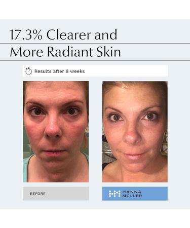 PHA Serum with Double Exfoliation - Reduce Fine Lines & Wrinkles, Brighten & Hydrate - 1 fl oz - Buy Online on GoSupps.com