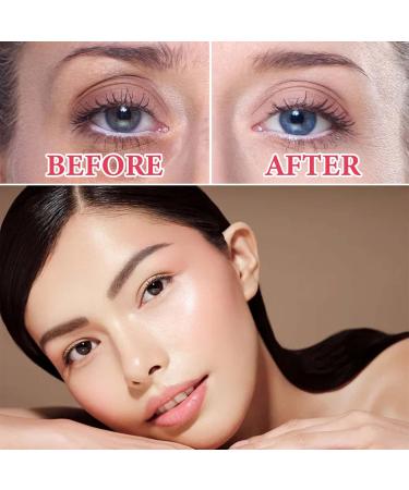 Retinol Eye Cream for Dark Circles & Puffiness - Collagen & Hyaluronic Acid Under Eye Gel for Wrinkles Brightening & Hydration - Buy Online on GoSupps.com