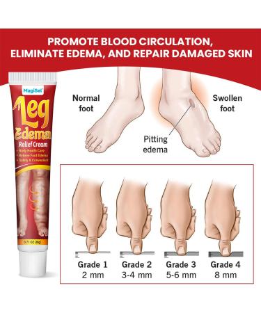 Cr me Anti- d me pour Jambes 20g Cr me de Soin des Jambes pour Affinement - Hydratante Anti- d me R duction Gonflement Mollet pour Femmes Hommes - Buy Online on GoSupps.com