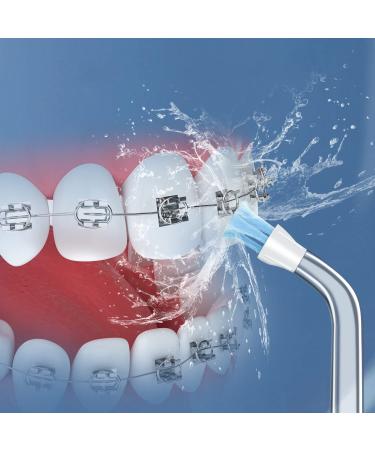 Waterpik Jet Tip Replacement Tips - AquaFlosser 6 Pack - Oral Irrigator Parts - Buy Online on GoSupps.com