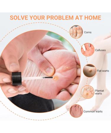 Wart Remover Liquid Fast Acting Salicylic Liquid to Remove Common and Plantar Warts Flat Warts 0.7 Fl Oz 1 Count - Buy Online on GoSupps.com