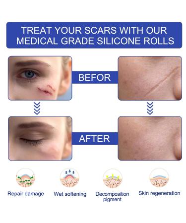 Transparent Scar Sheet Tape - Comfortable & Wide Application - Free Cutting for Protection - Buy Online on GoSupps.com