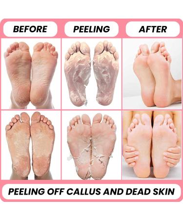 Korean Foot Peeling Masks 2PCS - KN FLAX - Repair Dead Skin Cells & Cracked Heels - Feet Peeling Mask with Hemp Oil & Kombucha Extract - Exfoliating & Hydrating - 2 Count - Buy Online on GoSupps.com