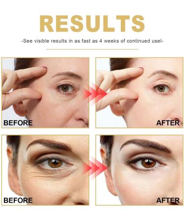 Face Essence OilNourishing Essential Facial Oil 15ml Skin Oil for Face Lift Firm Fade Fine Moisturizing Essence Firm & Smooth Skin for Women Losoo - Buy Online on GoSupps.com