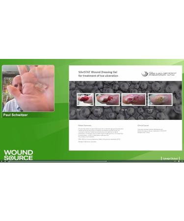 Nano Silver Wound Wash Sprayer | Effective Debridement & Fine Mist Spray | 4 fl oz | International Shipping Available - Buy Online on GoSupps.com