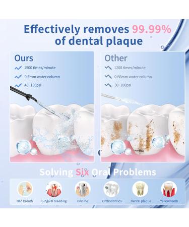 VITCOCO Water Flosser with Camera - Rechargeable Dental Flosser Waterpik 3 Nozzles IPX7 Waterproof for iOS & Android - Black - Buy Online on GoSupps.com