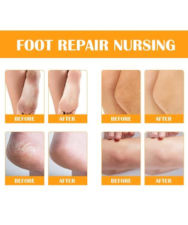 Hydrating Foot Peel Spray - Remove Dead Skin in Seconds | Exfoliating & Nourishing (Orange) - Buy Online on GoSupps.com