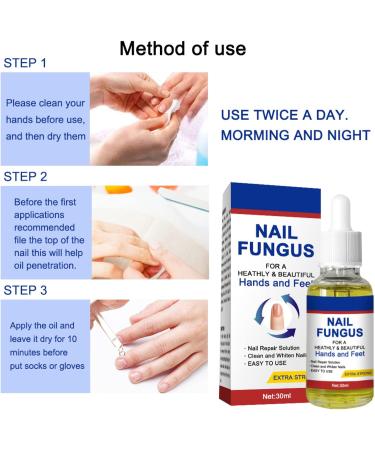 Nail Fungal Treatment Toenail Treatment Extra Strong Nail Repair Set Fingernail Toenail Care Fix Renew Damaged Broken Anti Fungus Nail Repair - Buy Online on GoSupps.com