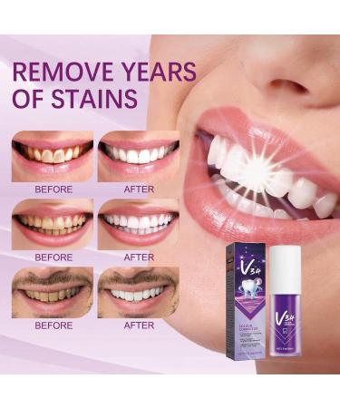 2PCS Purple Whitening Toothpaste V34 Color Correcting Toothpaste Whitening Toothpaste V34 Toothpaste Purple Correcting Toothpaste Oral Cleaning Toothpastes (Purple) - Buy Online on GoSupps.com