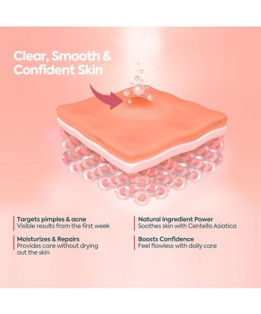 Clasy Care Acne Cream for Face Spot Treatment for Pimples & Acne Scars Salicylic Acid & Niacinamide for Scar Removal Teen & Adult Skincare with Zinc PCA - Buy Online on GoSupps.com