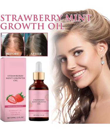 Strawberry Mint Growth Oil Strawberry Mint Hair Growth Oil Natural Rosemary Hair Essential Oil Strawberry Oil for Hair Growth Strawberry Essential Oil Rosemary Oil for Hair Growth & Skin Care 1 - Buy Online on GoSupps.com