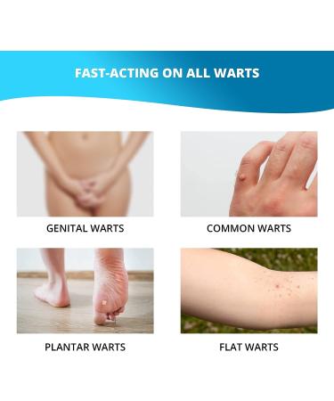 Uforic Health Wart Remover - Maximum Strength Treatment for Genital & Plantar Warts - Men & Women (1-Pack) - Buy Online on GoSupps.com