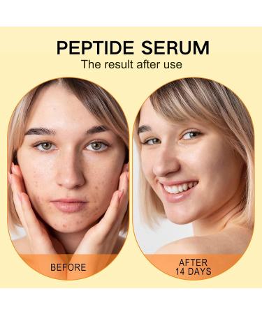 Peptide Complex Serum Hyaluronic Acid Serum Anti Aging Serum for Face Peptide Serum Face Serum for Women Hydrating Serum Reduce Wrinkle & Boost Collagen Plump & Repair Skin Brighten Skin - Buy Online on GoSupps.com