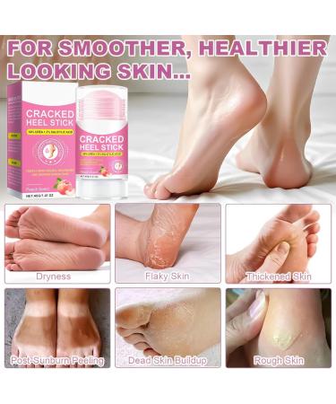  TQEBWUS Dry Foot Cream - Nourishing Moisturizing Stick 40g - Skin Softening Stick | Daily Night Travel Bathroom Home Personal Care for Cracked Heels - Buy Online on GoSupps.com