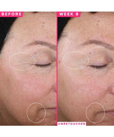 Farmacy 1% Vitamin A Anti Wrinkle Retinol Serum - Resurfacing Formula with Upcycled Ingredients - 1 Fl Oz - Buy Online on GoSupps.com