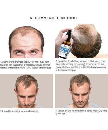 Growth Hair Oil Spray - Repair Follicles & Strengthen Roots | DHT Blocker | Nourishing 30ml - Buy Online on GoSupps.com