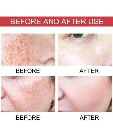 2Pcs Repair Serum Secret Skin Firming Rejuvenating Cream For All Skin Types (A) - Buy Online on GoSupps.com