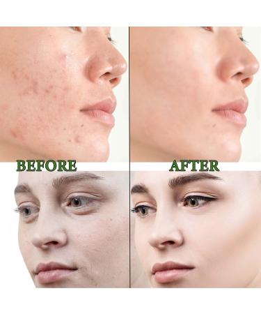 Moisturizing Green Tea Mask Stick | Deep Pore Cleansing & Oil Control | Hydrating Face Mask for All Skin Types - Buy Online on GoSupps.com