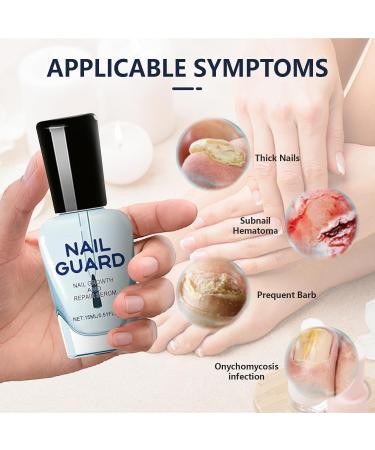  ZLHHRZJX Onyxoguard Growth and Repair Serum Treatment Foam Strengthening Foam for Feet and Main Dishes Growth Operation Station (2 OCS) - Buy Online on GoSupps.com