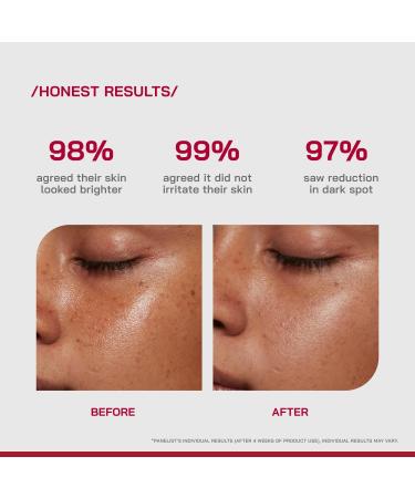 /PHD/ 10% Vitamin C Brightening Serum | For Glowing skin Oily skin Dry skin | Dark Spots & Uneven Tone Treatment | Face serum for Women & Men | Formulated with Global Dermatologists | 30ml - Buy Online on GoSupps.com