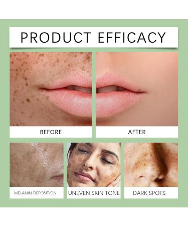 Dark Spot Remover for Face - Repair Face Cream - Face Cream for Women - Face Moisturiser for Dark Spot Correcting - Moisturizing and Anti-Blemish Spot Cream (30g) - Buy Online on GoSupps.com