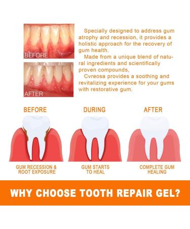 Advanced Gum Repair Ampoules & Essence | Anti-Inflammatory Tooth White Serum & Tartar Removal Gel (2 Box) - International Shipping - Buy Online on GoSupps.com