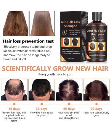 Shampoing de Croissance Cheveux Hair Growth Shampoo Shampoing Anti Chute Pour Les Hommes et Femmes Favoriser la Croissance des Cheveux for All Hair Types 220ml - Buy Online on GoSupps.com