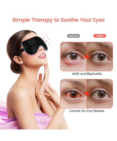 ABYON Heated Eye Mask - Moist Warm Compress for Dry Eyes Therapy - Buy Online on GoSupps.com