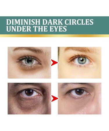 FOCUSUN Jasminsalbe for dark circles Jasminsalbe eye cream with collagen and aloe vera extract eye cream against dark circles removes bags and swelling 100ml 100 ml - Buy Online on GoSupps.com