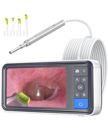 ScopeAround Ear Wax Removal Camera with 4.5" IPS Screen, 1920x1080 FHD Smart Visual Ear Cleaner with Camera Tool Kit, Plug & Play at Home Ear Infection Detector Ear Wax Remover Otoscope with Light