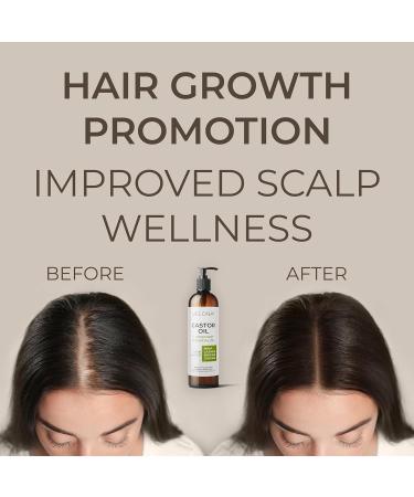 Velona Castor Oil with Rosemary - 8 oz | Natural Hair Growth Oil for Hair Scalp Eyelashes & Eyebrows | 100% Pure - Buy Online on GoSupps.com