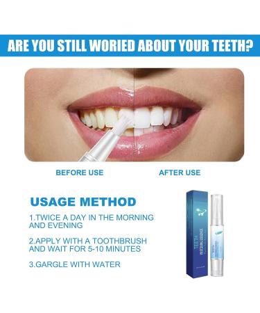 Sky Blue Teeth Whitening Pen: Instant Whitening Gel for Stain Removal and Teeth Brightening - Buy Online on GoSupps.com