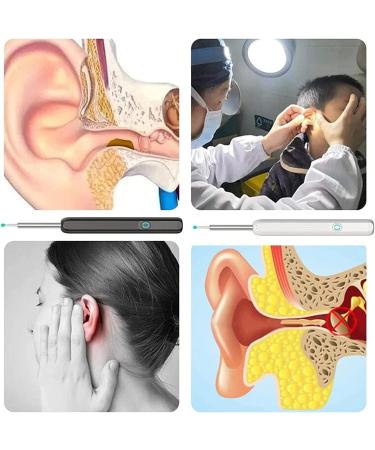 WiFi Ear Cleaner with 1080p HD Camera for iOS/Android - White - Buy Online on GoSupps.com