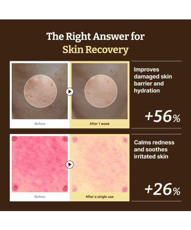 Dr. Reju-All The Anti-Aging Routine Set: Advanced PDRN Rejuvenating Cream + Retino-Mela Serum + LC-Ceramide Barrier Cream - All-in-one Korean Pharmacy Skin Care for All Skin Types - Buy Online on GoSupps.com