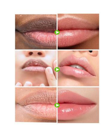 Lip Lightening Balm for Dark Lips Dark Lips Treatment Cream for Smokers Long-Lasting Moisturizer Nourishes & Plumps Lip Care Natural Balm for Dry Cracked and Dull Lips Fades Lip Lines - Buy Online on GoSupps.com