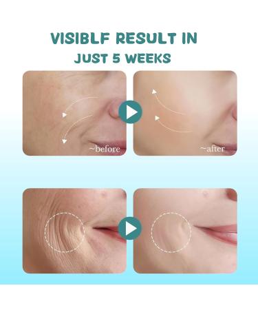 6-in-1 Tightening Neck Cream for Anti-Aging & Lift | Retinol Peptide & Hyaluronic Acid Face Moisturizer | Anti-Wrinkle Sagging Skin & Firming Care 40 ML - Buy Online on GoSupps.com
