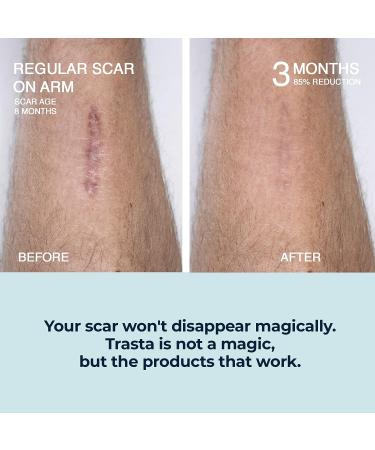 Trasta Medica Silicone Scar Sheets - 4 Pcs Surgical & Old Scars Tape - Natural Silicone Gel for Skin Friendly Treatment - Acne, C-Section & Burns - Buy Online on GoSupps.com