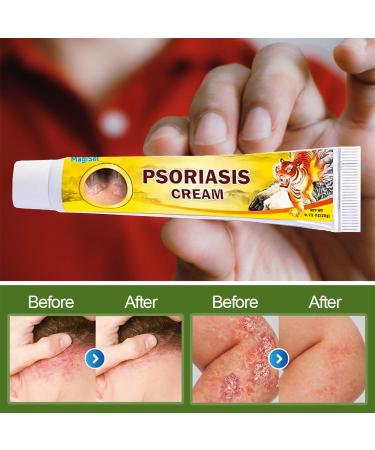  MagiSel Anti-itch ointment soothing skin cream for itching and psoriasis natural care formula skin cream cares for and soothes the skin non-irritating (20 g) - Buy Online on GoSupps.com
